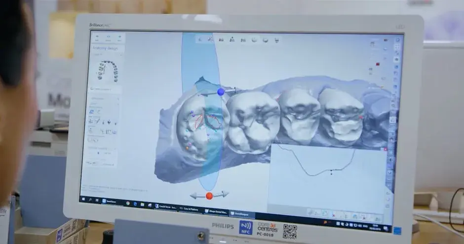 NextDent 5100 | 3D Systems